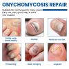 Ximonth Nail Fungus Patches, Hand And Foot Nails Inlaid Nail Thickening Gray Nail Brightening Nail Patch